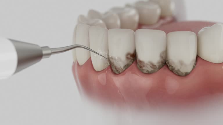 Reliable Dental Implants contractor in Redmond, OR by Smile Center Dentistry